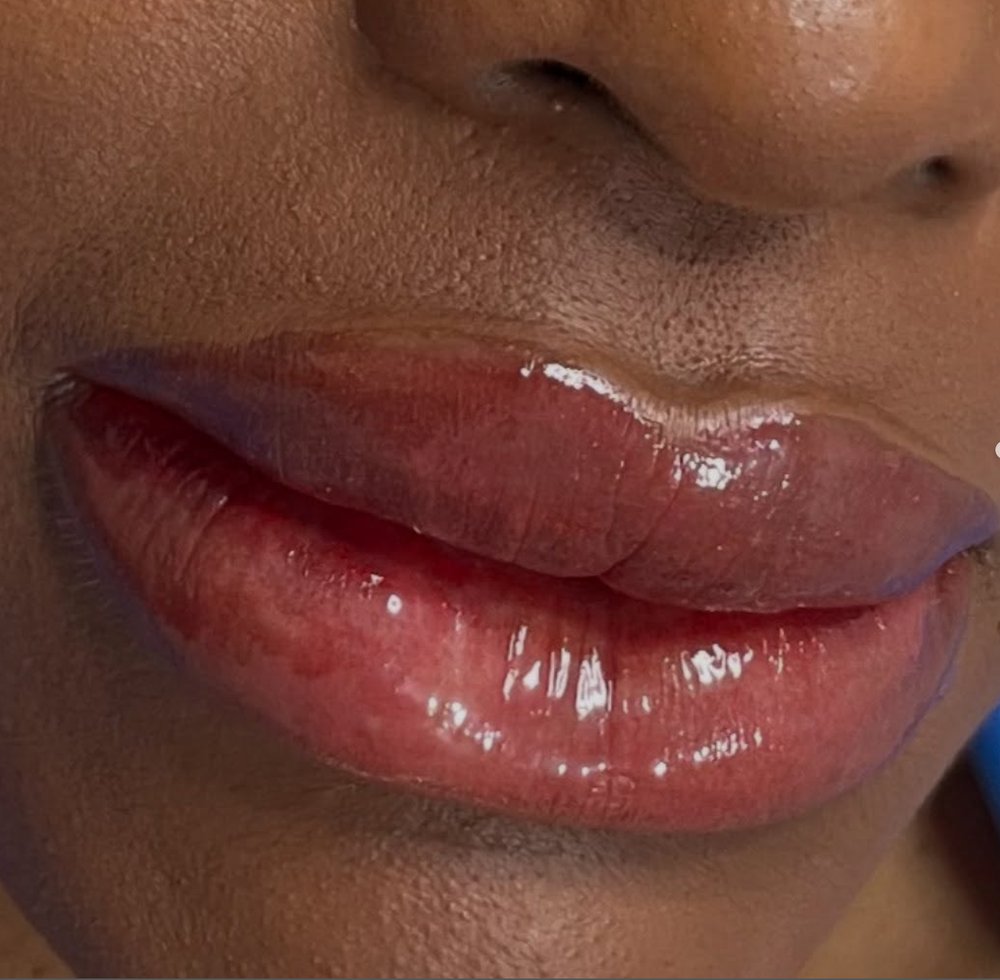 Resultado de micropigmentação labial, lábios definidos e naturais